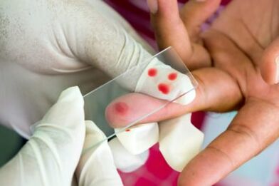 Diagnosi di dolore nelle articolazioni delle dita