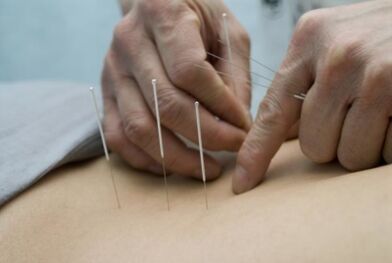 Agopuntura per l'osteocondrosi della regione toracica