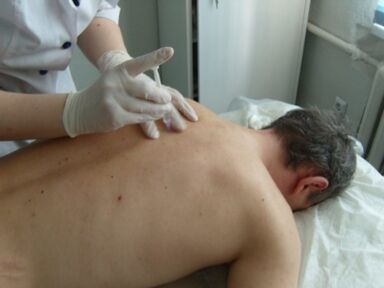 Iniezioni intrarticolari di condroprotettori per l'osteocondrosi toracica